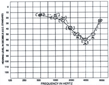 Example of an Audiogram