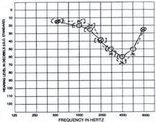 Hearing Test Frequency Chart